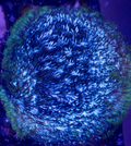 Blue Leptoseris